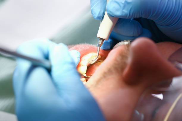 Best Emergency Broken Tooth Repair in Helemano, HI
